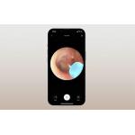 Otoscop cu camera pentru curatarea urechilor Bebird M9 S, 10MP, 230 mAh, Control aplicatie, Negru 4 - lerato.ro