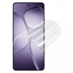 Set 2 folii protectie Bizon Hydrogel compatibile cu Xiaomi 14T / 14T Pro, Transparent 6 - lerato.ro