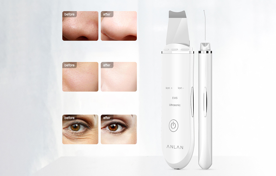 Aparat de curatare faciala ANLAN Skin Scrubber ALDRY03-02, 4 moduri, 500 mAh, 1.5W, Alb 1 Lerato.ro