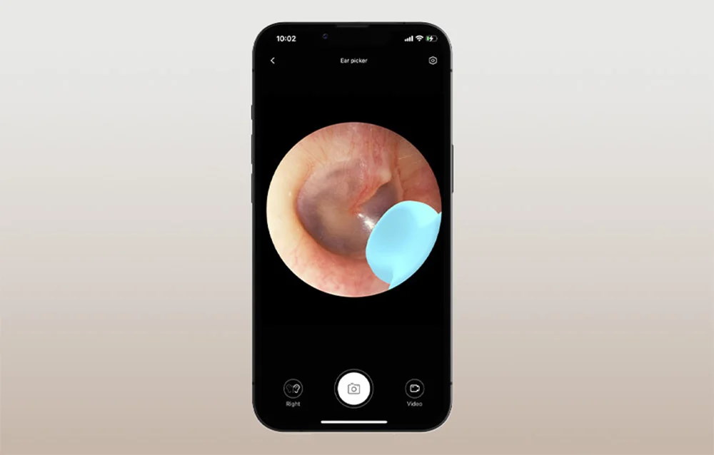 Otoscop cu camera pentru curatarea urechilor Bebird M9 S, 10MP, 230 mAh, Control aplicatie, Negru 1 Lerato.ro